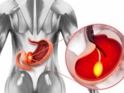 Ung thư tuyến tụy là sát thủ thầm lặng, làm thế nào để tránh?