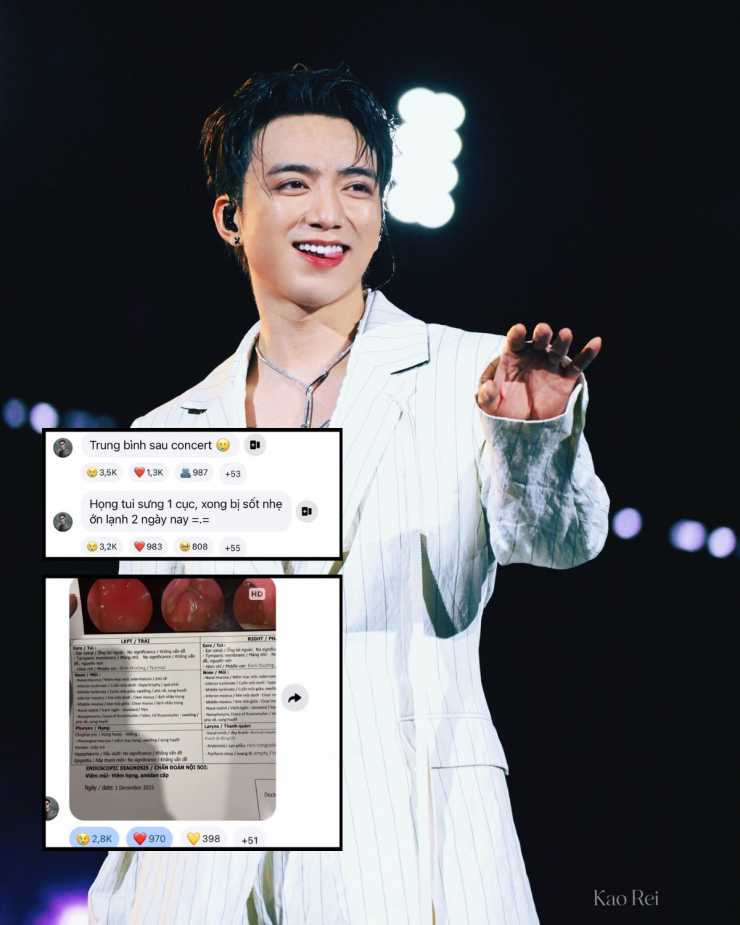 Kết quả khám bệnh của SOOBIN hậu Live Concert khiến fan lo lắng.