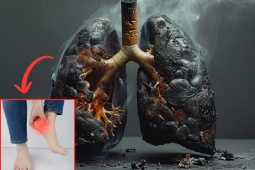Tin tức sức khỏe - 3 “tín hiệu khẩn” cho thấy phổi đang “nguy kịch”, đi khám ngay kẻo ân hận cả đời!