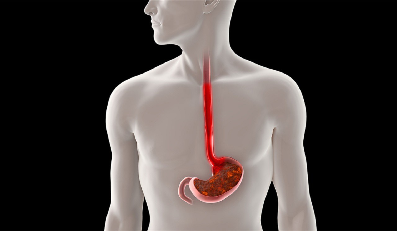 Những món người Việt yêu thích không ngờ làm tăng nguy cơ mắc ung thư thực quản - 3