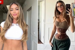 Những cô gái cắt xương sườn tìm 'eo con kiến'