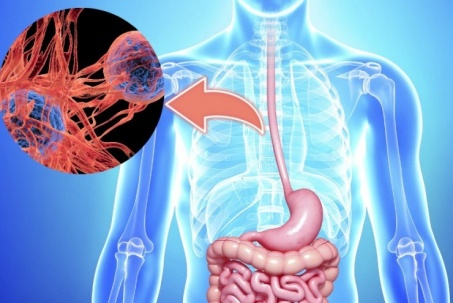 Những món người Việt yêu thích không ngờ làm tăng nguy cơ mắc ung thư...