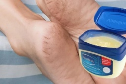 Cách khắc phục tình trạng da gót chân khô, nứt nẻ mùa đông