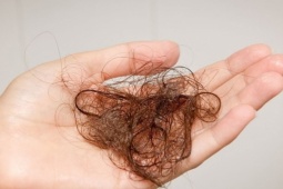 Rụng tóc kéo dài do sức khỏe đường ruột kém và cách khắc phục