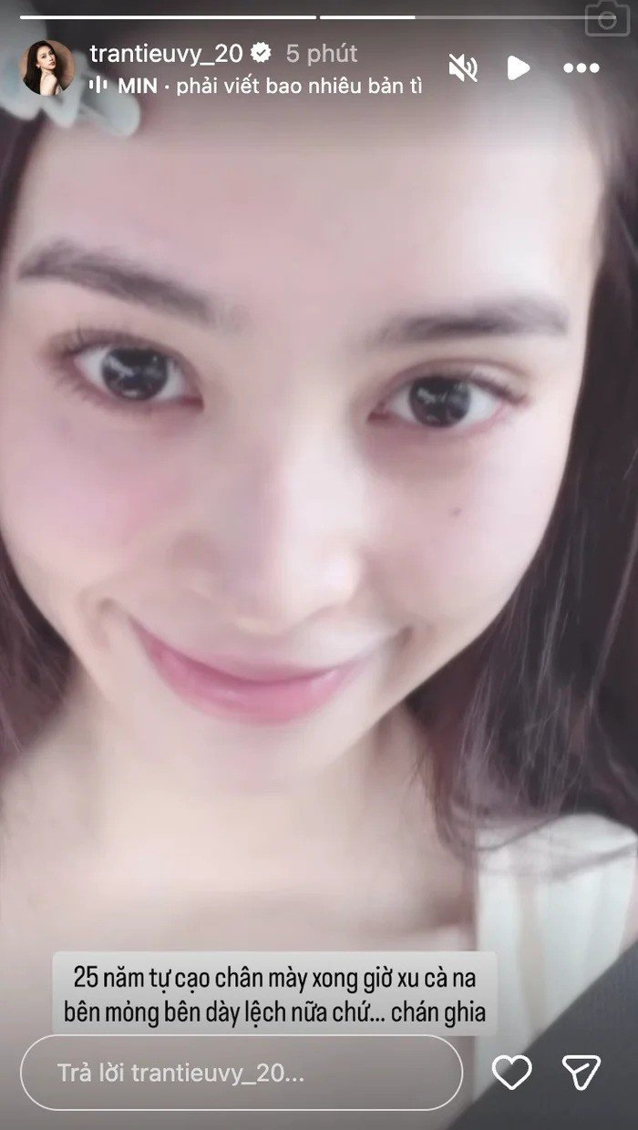 Hoa hậu Tiểu Vy gặp sự cố oái oăm khi tự làm đẹp, nhan sắc hiện tại ra sao? - 4