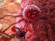 Tế bào ung thư 'sợ' nhất 5 thực phẩm rẻ tiền này, người Việt tăng cường ăn để ngừa bệnh, kéo dài tuổi thọ