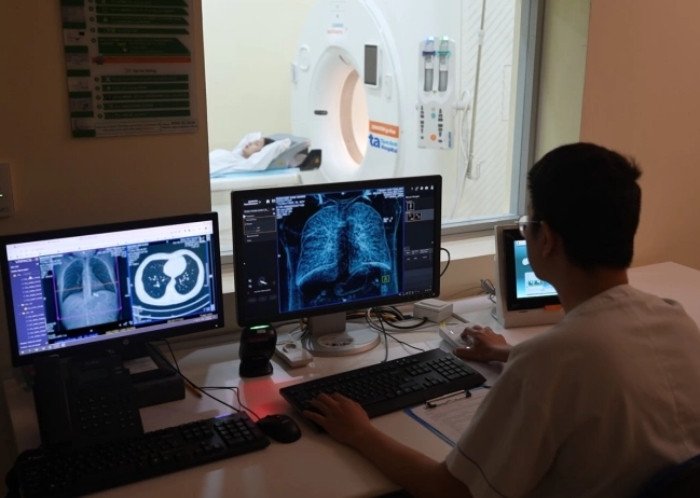 Tầm soát ung thư phổi bằng máy chụp cắt lớp vi tính. (Ảnh: BVCC)