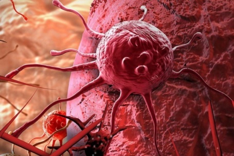 Tế bào ung thư 'sợ' nhất 5 thực phẩm rẻ tiền này, người Việt tăng...