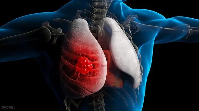 Người sống thọ, phổi khỏe thường hội tụ 5 đặc điểm này - 1