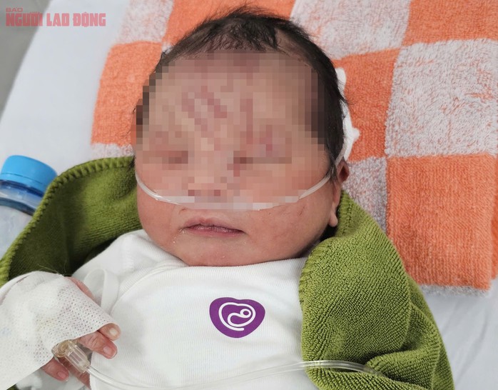 Bé sơ sinh có nhiều vết xước trên mặt và vết chấm đỏ ở cẳng tay, cẳng chân nghi do bị động vật cào và côn trùng đốt