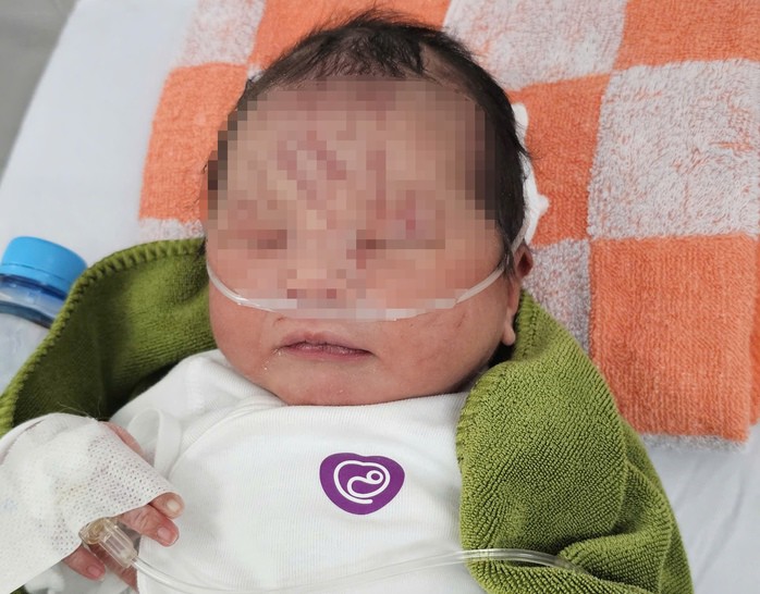 Tình trạng bé sơ sinh hiện ổn định, các bác sĩ tại Bệnh viện Nhi tỉnh Gia Lai đang tiếp tục chăm sóc