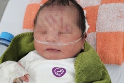 NÓNG: Một trẻ sơ sinh nghi bị "chôn sống" tại vườn cao su