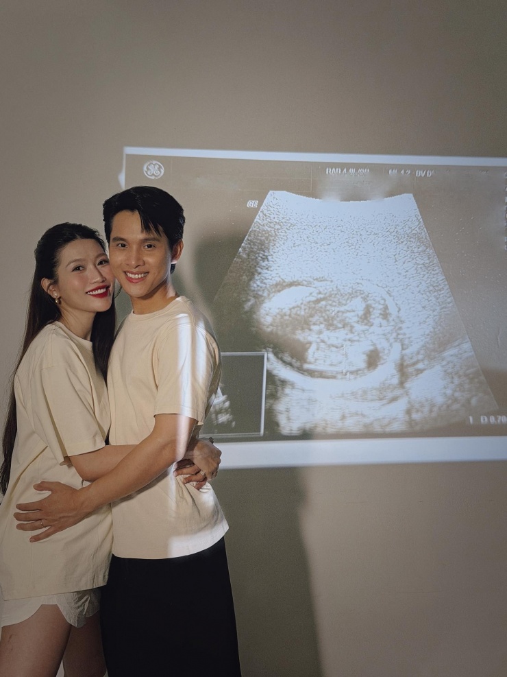 Á hậu Chế Nguyễn Quỳnh Châu và chồng doanh nhân báo tin vui.