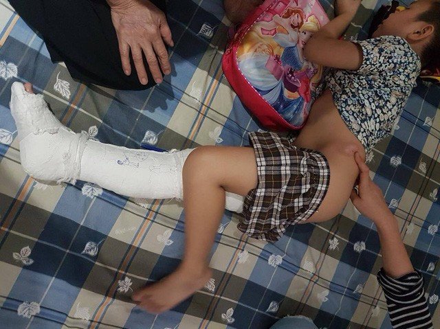 Học sinh Trường tiểu học Nam Trung Yên (Hà Nội) bị xe taxi đâm gãy chân năm 2017.