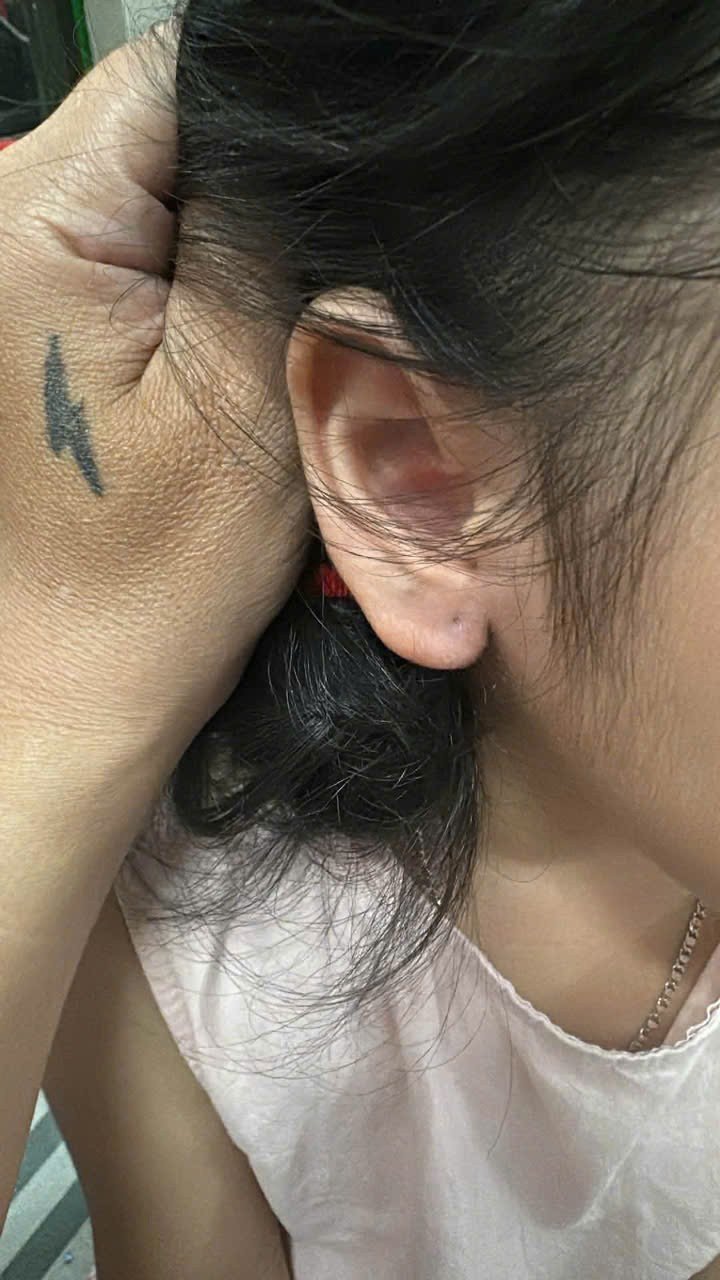 Hình ảnh bé gái sau khi bị tháo đôi bông tai.