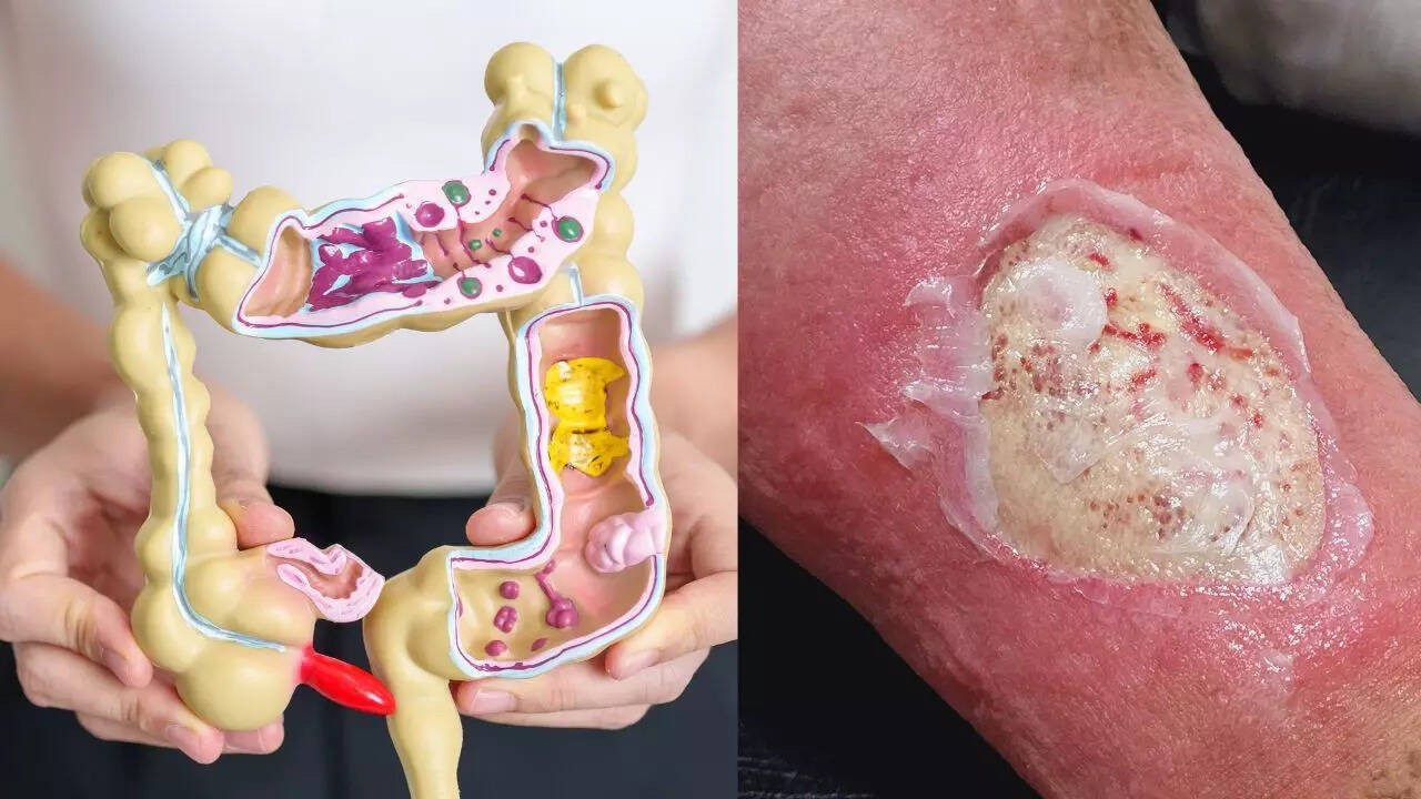 7 dấu hiệu trên da cảnh báo ung thư đại tràng, ai cũng cần biết - 1