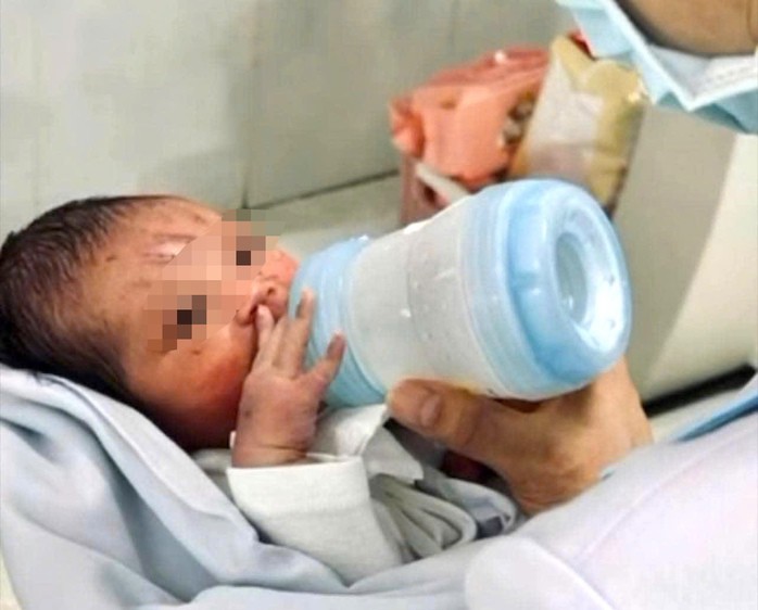 Bé sơ sinh đã dừng thở máy, bú sữa bình