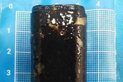 Người đàn ông sống với chiếc bật lửa trong bụng suốt 30 năm