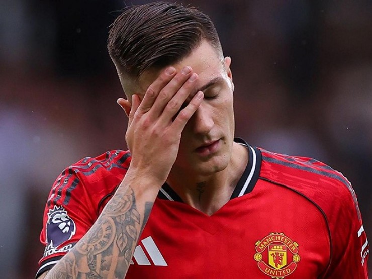 Sao MU Sesko bị ngộ độc, HLV Amorim bực bội vì 3 sao phải dự Cúp châu Phi