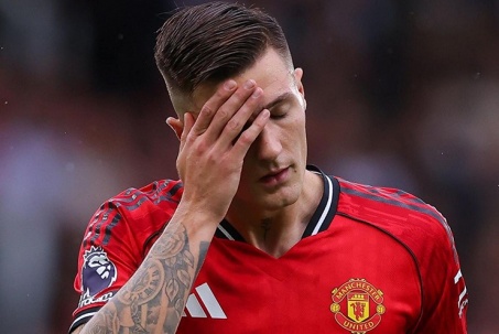 Sao MU Sesko bị ngộ độc, HLV Amorim bực bội vì 3 sao phải dự Cúp châu Phi