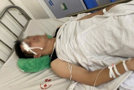 Xe buýt va chạm nhẹ với xe con, tài xế bị đánh chấn thương