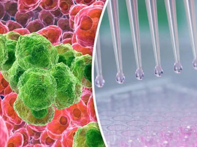 Tế bào ung thư sợ gì nhất?: Phát hiện nhiều 'điểm yếu' để loại bỏ tế bào ung thư