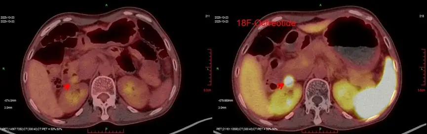 Hình ảnh siêu âm.