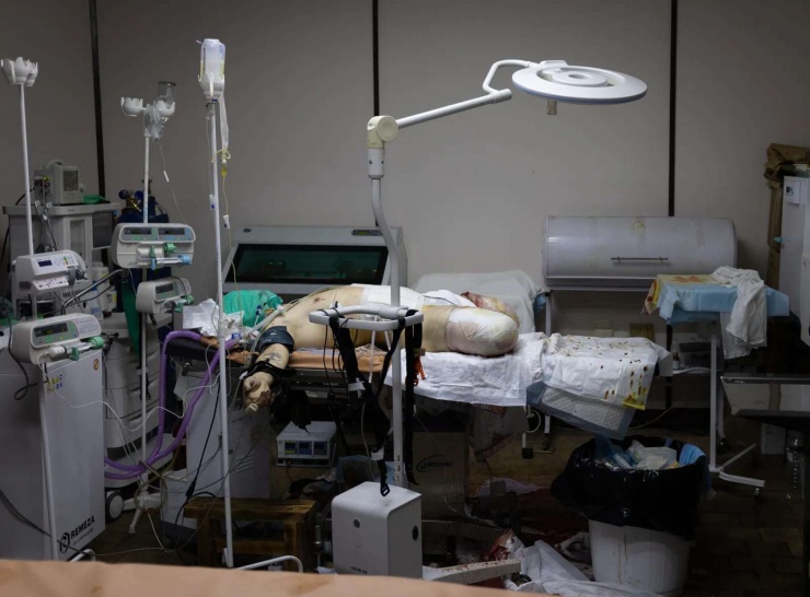 Một người lính Nga có mật danh là pavel nằm trên giường bệnh sau khi anh bị thương nặng phải cắt bỏ hai chân. Ảnh&nbsp;GORAN TOMASEVIC/The Globe and Mail