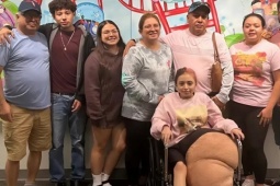 Cô bé 14 tuổi phải cắt bỏ chân voi nặng tới 77 kg