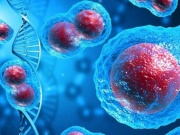 Tế bào ung thư hình thành như thế nào? Cơ thể cần gì để chống lại sự phát triển của chúng?