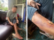 Xác định nhóm học sinh hành hung người đàn ông say rượu trong đêm ở Huế