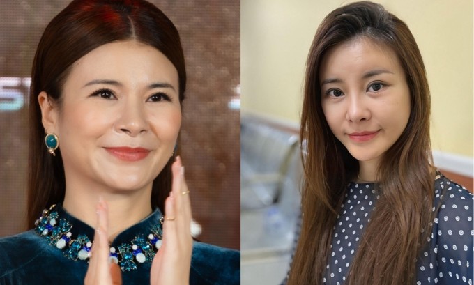 Diện mạo NSƯT Kim Oanh sau phẫu thuật trẻ hóa tại Hàn Quốc.