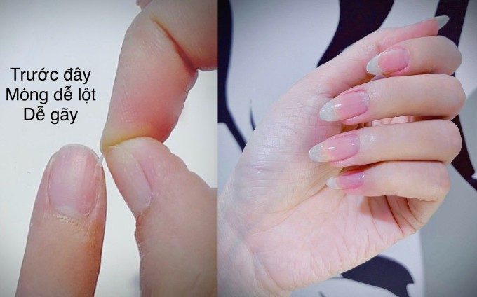 Thủy Tiên khoe móng tay trước đây và hiện tại.