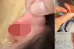 Xác minh vụ giáo viên tiểu học véo tai học sinh lớp 1 chảy máu ở Phú Quốc