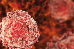 Tế bào ung thư phát triển thế nào trong cơ thể? Hiểu đúng để giảm nguy cơ mắc bệnh