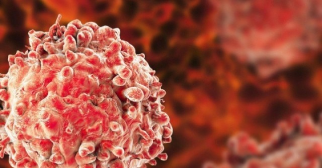 Tế bào ung thư phát triển thế nào trong cơ thể? Hiểu đúng để giảm nguy cơ mắc bệnh