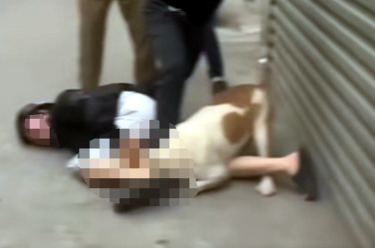 Người phụ nữ bị chó tấn công. Ảnh: B.C