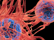 4 thực phẩm có đặc tính ngăn ngừa sự phát triển của tế bào ung thư, người Việt nên ăn nhiều hơn