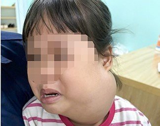 Khối u của bệnh nhi phát triển nhanh từng giờ.