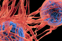 4 thực phẩm có đặc tính ngăn ngừa sự phát triển của tế bào ung thư, người Việt nên ăn nhiều hơn