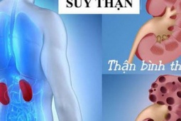 7 thói quen đơn giản giúp giảm nguy cơ suy thận người Việt nên làm