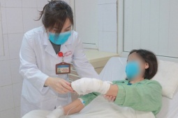 Người phụ nữ 47 tuổi ở Hà Nội bỏng nặng do sử dụng hóa chất thông bồn cầu phát nổ