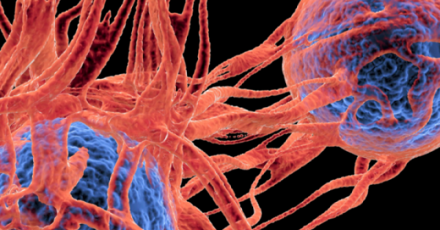 4 thực phẩm có đặc tính ngăn ngừa sự phát triển của tế bào ung thư, người Việt nên ăn nhiều hơn