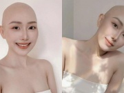 Cú sốc ung thư ở tuổi 28