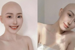 Cú sốc ung thư ở tuổi 28