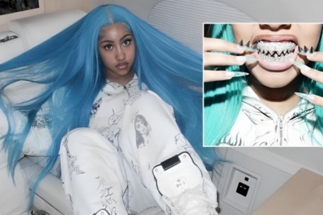 Con gái 12 tuổi của Kim Kardashian khoe bộ răng kim cương