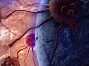 Tế bào ung thư 'thích' gì nhất? Cảnh báo 1 môi trường thuận lợi cho chúng phát triển