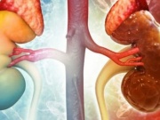 Chuyên gia Mỹ cảnh báo 4 món ăn dễ gây suy thận, hại thận, người Việt cần sớm thay đổi