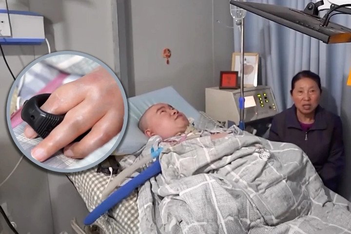 Li Xia nằm trên giường bệnh, phải nhờ đến máy thở để duy trì sự sống. (Ảnh: CCTV)