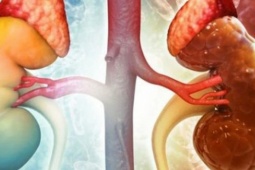 Chuyên gia Mỹ cảnh báo 4 món ăn dễ gây suy thận, hại thận, người Việt cần sớm thay đổi